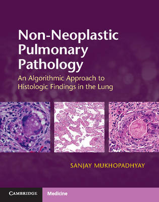 Sanjay Mukhopadhyay - Non-Neoplastic Pulmonary Pathology with Online Resource: An Algorithmic Approach to Histologic Findings in the Lung - 9781107443501 - V9781107443501