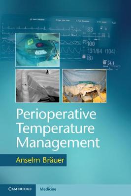 Anselm Brauer - Perioperative Temperature Management - 9781107535770 - V9781107535770