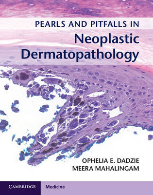 Ophelia E. Dadzie (Ed.) - Pearls and Pitfalls in Neoplastic Dermatopathology with Online Access - 9781107584587 - V9781107584587