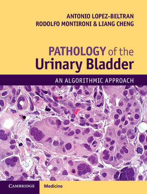 Antonio Lopez-Beltran - Pathology of the Urinary Bladder: An Algorithmic Approach - 9781107593374 - V9781107593374