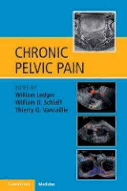 William Ledger - Chronic Pelvic Pain - 9781107636620 - V9781107636620