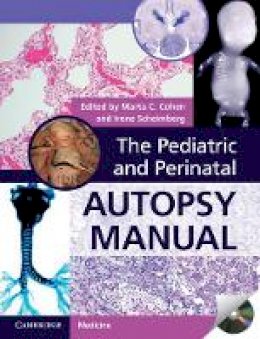 Marta C. Cohen (Ed.) - The Pediatric and Perinatal Autopsy Manual with DVD-ROM - 9781107646070 - V9781107646070