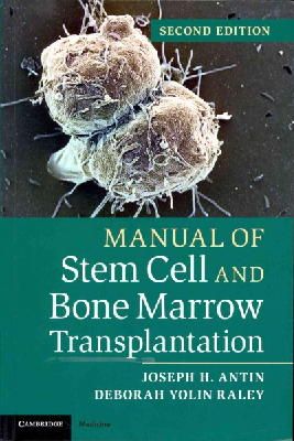Joseph H. Antin - Manual of Stem Cell and Bone Marrow Transplantation - 9781107661547 - V9781107661547