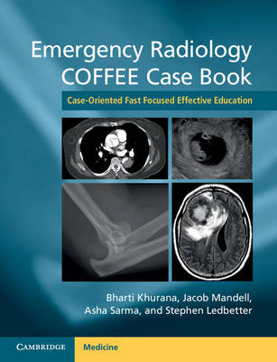 Bharti Khurana - Emergency Radiology COFFEE Case Book: Case-Oriented Fast Focused Effective Education - 9781107690769 - V9781107690769