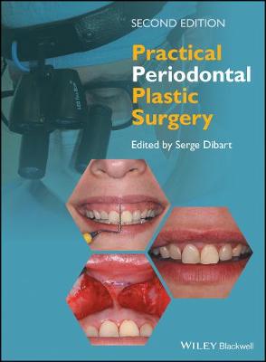 Serge Dibart (Ed.) - Practical Periodontal Plastic Surgery - 9781118360651 - V9781118360651
