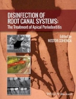 Nestor Cohenca - Disinfection of Root Canal Systems: The Treatment of Apical Periodontitis - 9781118367681 - V9781118367681