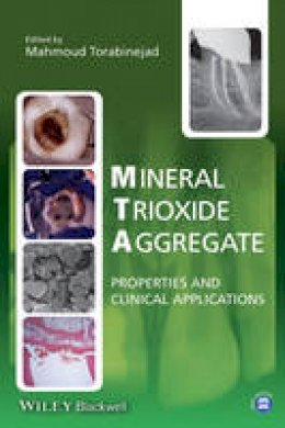 Mahmoud Torabinejad - Mineral Trioxide Aggregate: Properties and Clinical Applications - 9781118401286 - V9781118401286