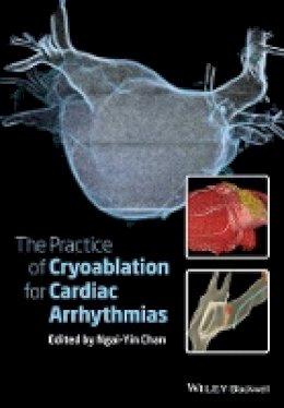 Ngai-Yin Chan (Ed.) - The Practice of Catheter Cryoablation for Cardiac Arrhythmias - 9781118451830 - V9781118451830