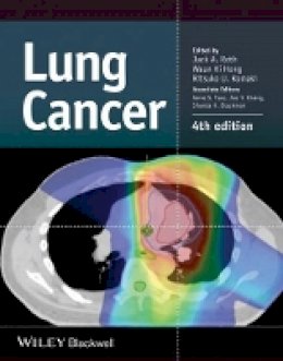 Jack A. Roth (Ed.) - Lung Cancer - 9781118468746 - V9781118468746