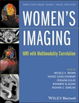 Michele A. Brown - Women´s Imaging: MRI with Multimodality Correlation - 9781118482841 - V9781118482841
