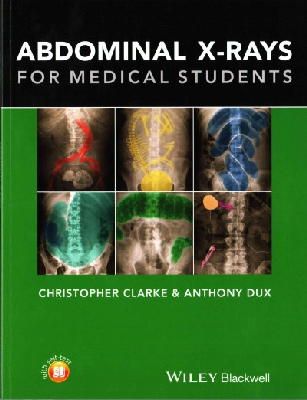 Christopher Clarke - Abdominal X-rays for Medical Students - 9781118600559 - V9781118600559