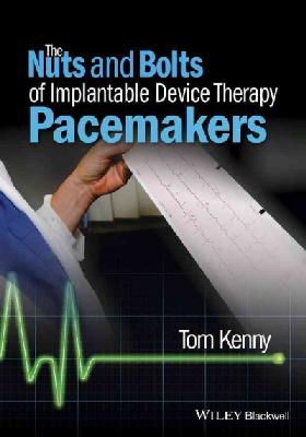 Tom Kenny - The Nuts and Bolts of Implantable Device Therapy: Pacemakers - 9781118670675 - V9781118670675