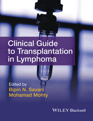 Savani, Bipin N.; Mohty, Mohamad - Clinical Guide to Transplantation in Lymphoma - 9781118863329 - V9781118863329