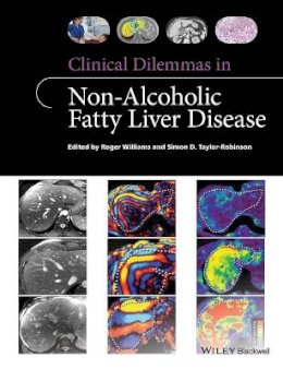 Roger Williams - Clinical Dilemmas in Non-Alcoholic Fatty Liver Disease - 9781118912034 - V9781118912034