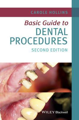Carole Hollins - Basic Guide to Dental Procedures - 9781118924556 - V9781118924556