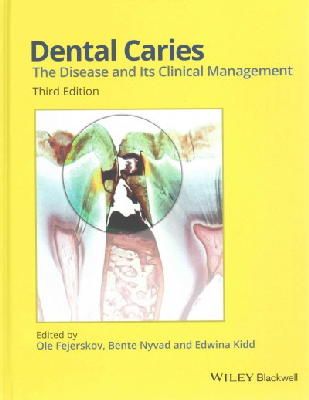 Ole Fejerskov - Dental Caries: The Disease and its Clinical Management - 9781118935828 - V9781118935828