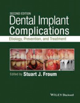 Stuart Froum - Dental Implant Complications: Etiology, Prevention, and Treatment - 9781118976456 - V9781118976456