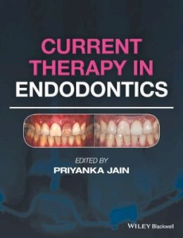 Priyanka Jain - Current Therapy in Endodontics - 9781119067559 - V9781119067559