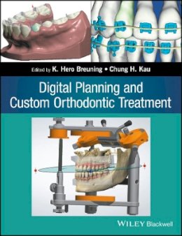 K. Hero Breuning - Digital Planning and Custom Orthodontic Treatment - 9781119087779 - V9781119087779
