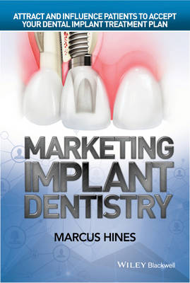 Marcus Hines - Marketing Implant Dentistry: Attract and Influence Patients to Accept Your Dental Implant Treatment Plan - 9781119114512 - V9781119114512