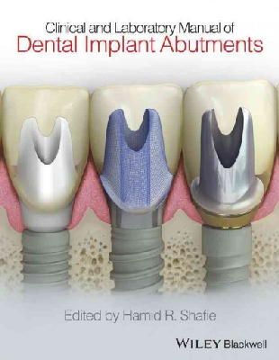 Hamid Shafie - Clinical and Laboratory Manual of Dental Implant Abutments - 9781119949817 - V9781119949817 Hamid Shafie - Clinical and Laboratory Manual of Dental Implant Abutments - 9781119949817 - V9781119949817