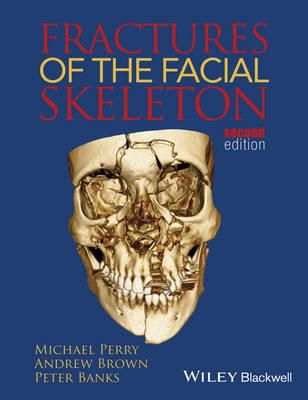 Michael Perry - Fractures of the Facial Skeleton - 9781119967668 - V9781119967668