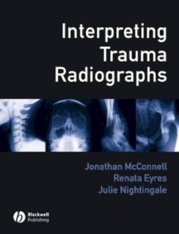 Mcconnell - Interpreting Trauma Radiographs - 9781405115346 - V9781405115346