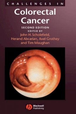 Scholefield - Challenges in Colorectal Cancer - 9781405127066 - V9781405127066
