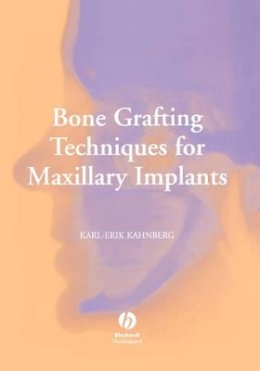 Karl-Erik Kahnberg - Bone Grafting Techniques for Maxillary Implants - 9781405129947 - V9781405129947