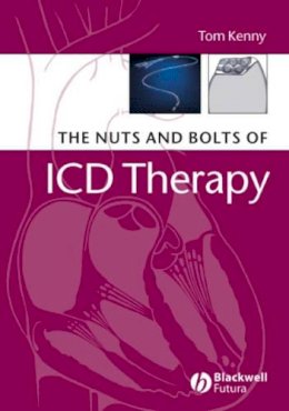 Tom Kenny - The Nuts and Bolts of ICD Therapy - 9781405135115 - V9781405135115