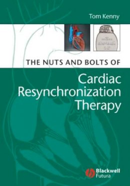 Tom Kenny - The Nuts and Bolts of Cardiac Resynchronization Therapy - 9781405153720 - V9781405153720
