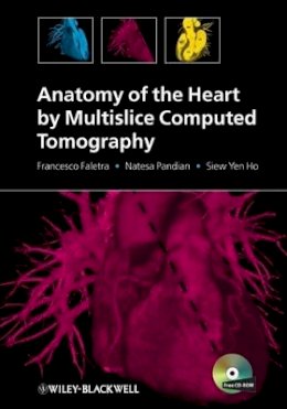 Francesco Faletra - Anatomy of the Heart by Multislice Computed Tomography - 9781405180559 - V9781405180559