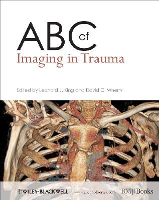 Roger Hargreaves - ABC of Imaging in Trauma - 9781405183321 - V9781405183321