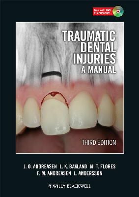 Jens O. Andreasen - Traumatic Dental Injuries: A Manual - 9781405190619 - V9781405190619