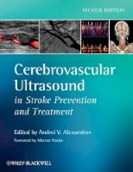 Andrei V Alexandrov - Cerebrovascular Ultrasound in Stroke Prevention and Treatment - 9781405195768 - V9781405195768