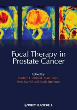 Hashim Uddin Ahmed - Focal Therapy in Prostate Cancer - 9781405196499 - V9781405196499
