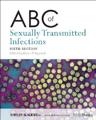 Karen Rogstad - ABC of Sexually Transmitted Infections - 9781405198165 - V9781405198165