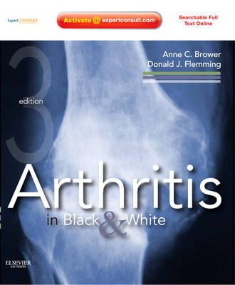 Anne C. Brower - Arthritis in Black and White: Expert Consult - Online and Print - 9781416055952 - V9781416055952