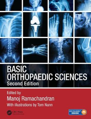 Manoj Ramachandran - Basic Orthopaedic Sciences - 9781444120981 - V9781444120981
