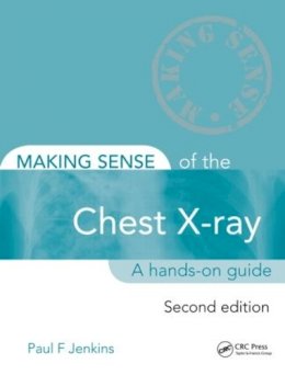 Paul Jenkins - Making Sense of the Chest X-ray: A hands-on guide - 9781444135152 - V9781444135152