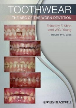 Farid Khan - Toothwear: The ABC of the Worn Dentition - 9781444336559 - V9781444336559