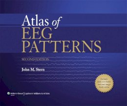 John M. Stern - Atlas of EEG Patterns - 9781451109634 - V9781451109634