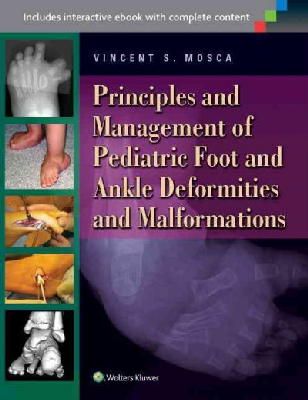 Vincent Mosca - Principles and Management of Pediatric Foot and Ankle Deformities and Malformations - 9781451130454 - V9781451130454