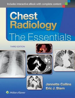 Janette Collins - Chest Radiology: The Essentials - 9781451144482 - V9781451144482