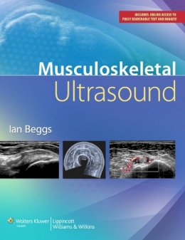 Dr. Ian Beggs - Musculoskeletal Ultrasound - 9781451144987 - V9781451144987