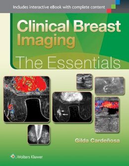 Gilda Cardenosa - Clinical Breast Imaging: The Essentials (Essentials series) - 9781451151770 - V9781451151770