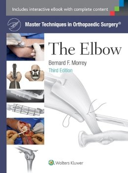 Bernard F. Morrey - Master Techniques in Orthopaedic Surgery: The Elbow - 9781451173093 - V9781451173093