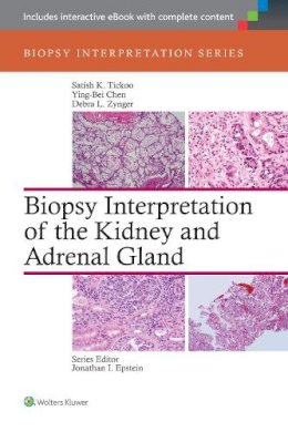 Satish Tickoo - Biopsy Interpretation of the Kidney & Adrenal Gland - 9781451176476 - V9781451176476