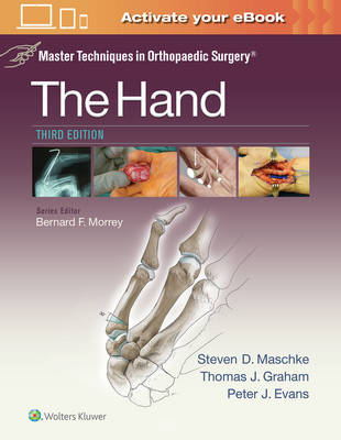 Graham  - Master Techniques in Orthopaedic Surgery: The Hand - 9781451182781 - V9781451182781