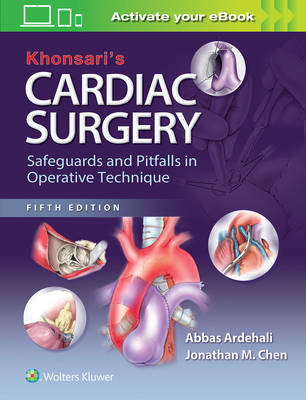 Abbas Ardehali - Khonsari's Cardiac Surgery: Safeguards and Pitfalls in Operative Technique - 9781451183689 - V9781451183689